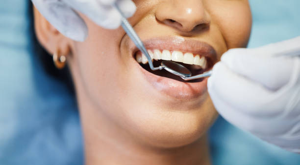 Emergency Cosmetic Dentistry (e.g., broken veneers)