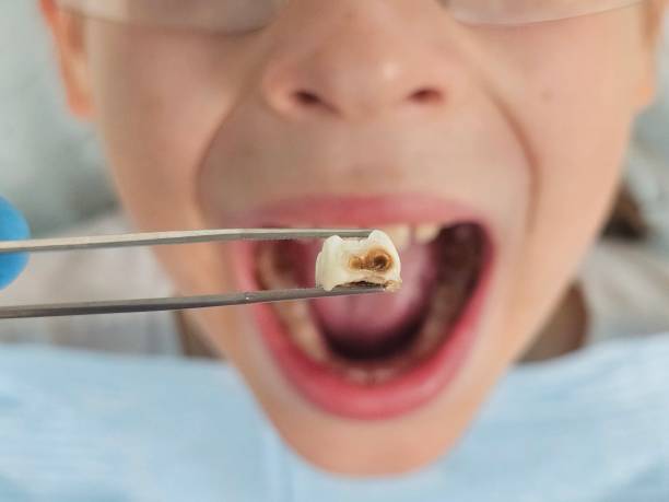  Raymond, IL Emergency Dentist Pros